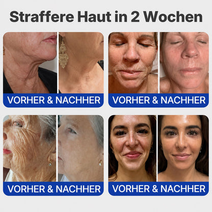 【⏰Nur noch 10 MINUTEN – Aktion endet bald!⏰】