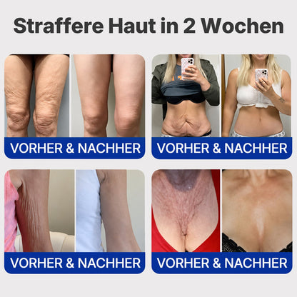 【⏰Nur noch 10 MINUTEN – Aktion endet bald!⏰】