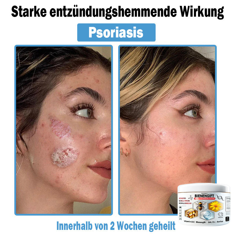 [Nur noch 10 Minuten] (𝐨𝐟𝐟𝐢𝐳𝐢𝐞𝐥𝐥 𝐳𝐞𝐫𝐭𝐢𝐟𝐢𝐳𝐢𝐞𝐫𝐭)